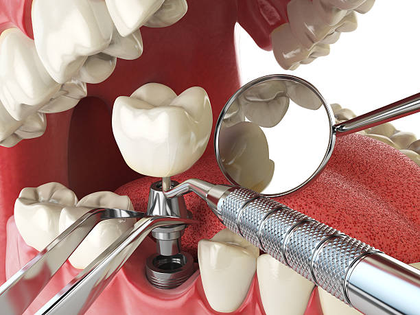 Best Weekend Emergency Dentist in Fishhook, AK