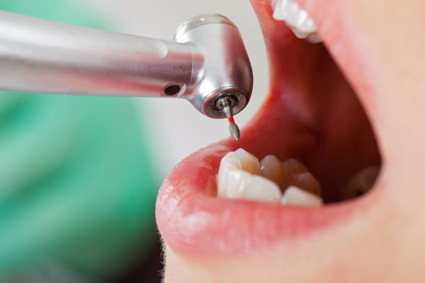 Best After-Hours Dental Trauma Care in Fishhook, AK